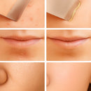 Peeling Esfoliante Ultrassônico Limpeza Facial e Removedor de Cravos